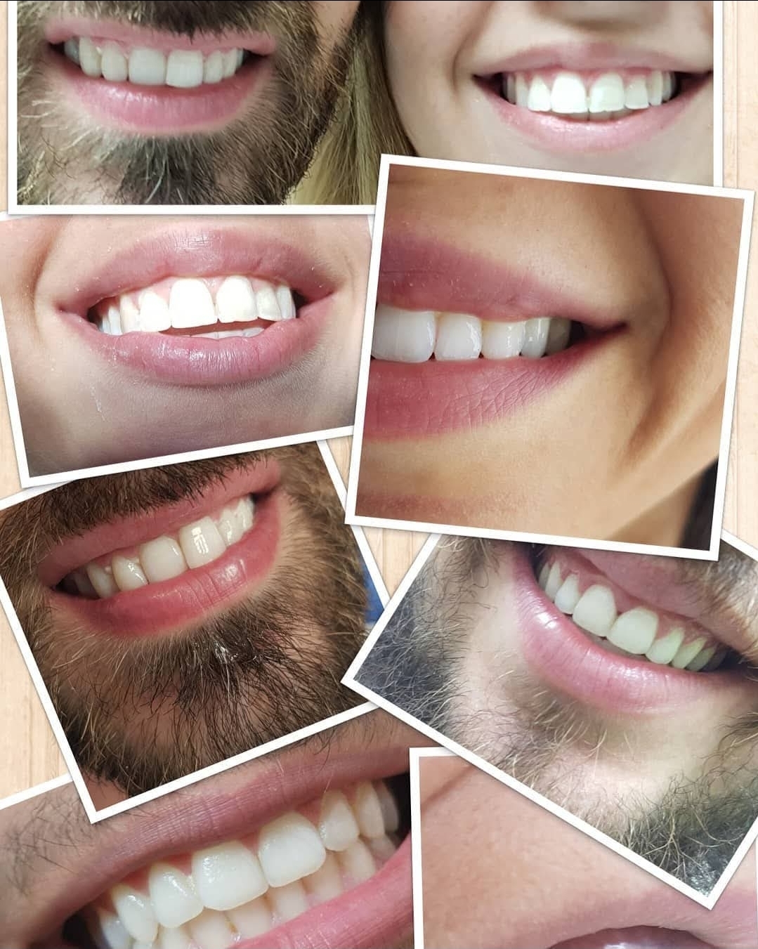 חיוכים של מטופלים אמיתיים לאחר הטיפול